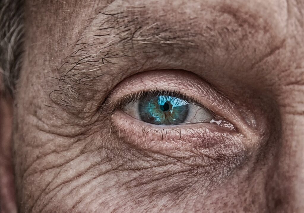 ケミカルピーリングを50代におすすめする肌質別の効果は？