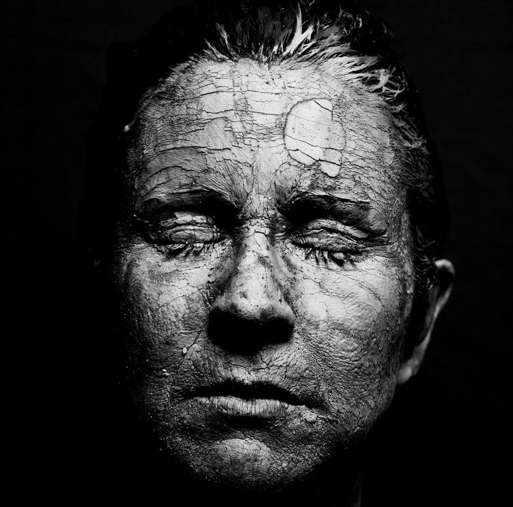 50代の皮膚の薄さを改善する治療法は？
