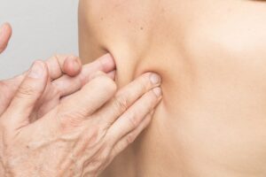 50代が知っておくべきPRPのデメリットとは？